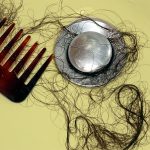 Hair loss in women