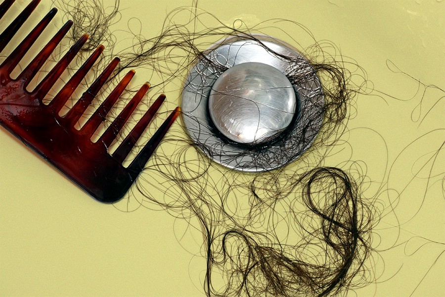 Hair loss in women