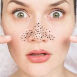 get rid of your blackheads